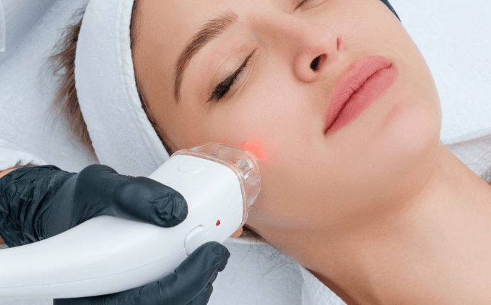 4 Laser Treatments To Revitalize Your Skin